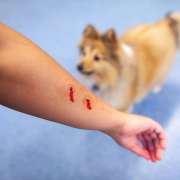 Dog bites: What is the law in Kentucky