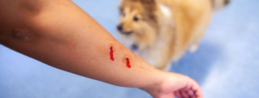 Dog bites: What is the law in Kentucky