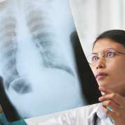I Have an Asbestos-Related Disease