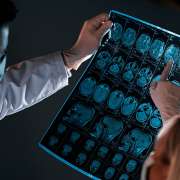 What are the Long-Term Effects of Brain Injuries?