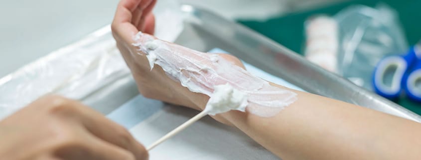 Burn Injuries May Leave You Disabled