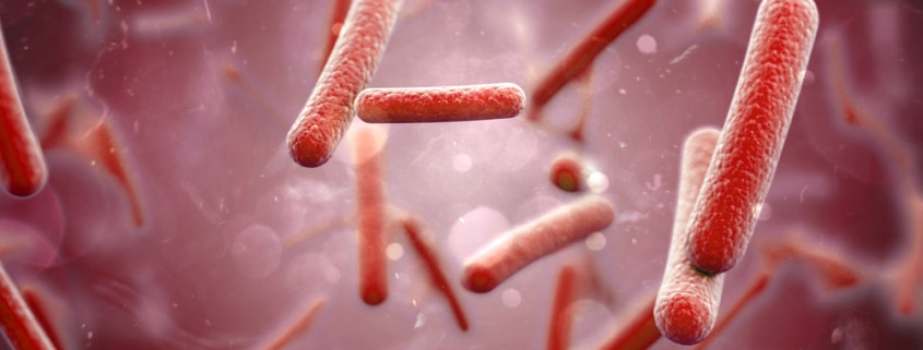 An Infection is a Leading Cause of Death in Kentucky